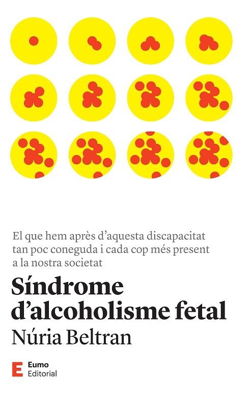 SÍNDROME D'ALCOHOLISME FETAL | 9788497668149 | BELTRAN CENTELLES, NÚRIA | Llibreria L'Altell - Llibreria Online de Banyoles | Comprar llibres en català i castellà online - Llibreria de Girona